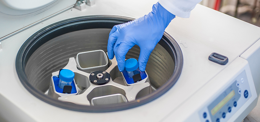 Cuánto cuesta el tratamiento mediante membranas